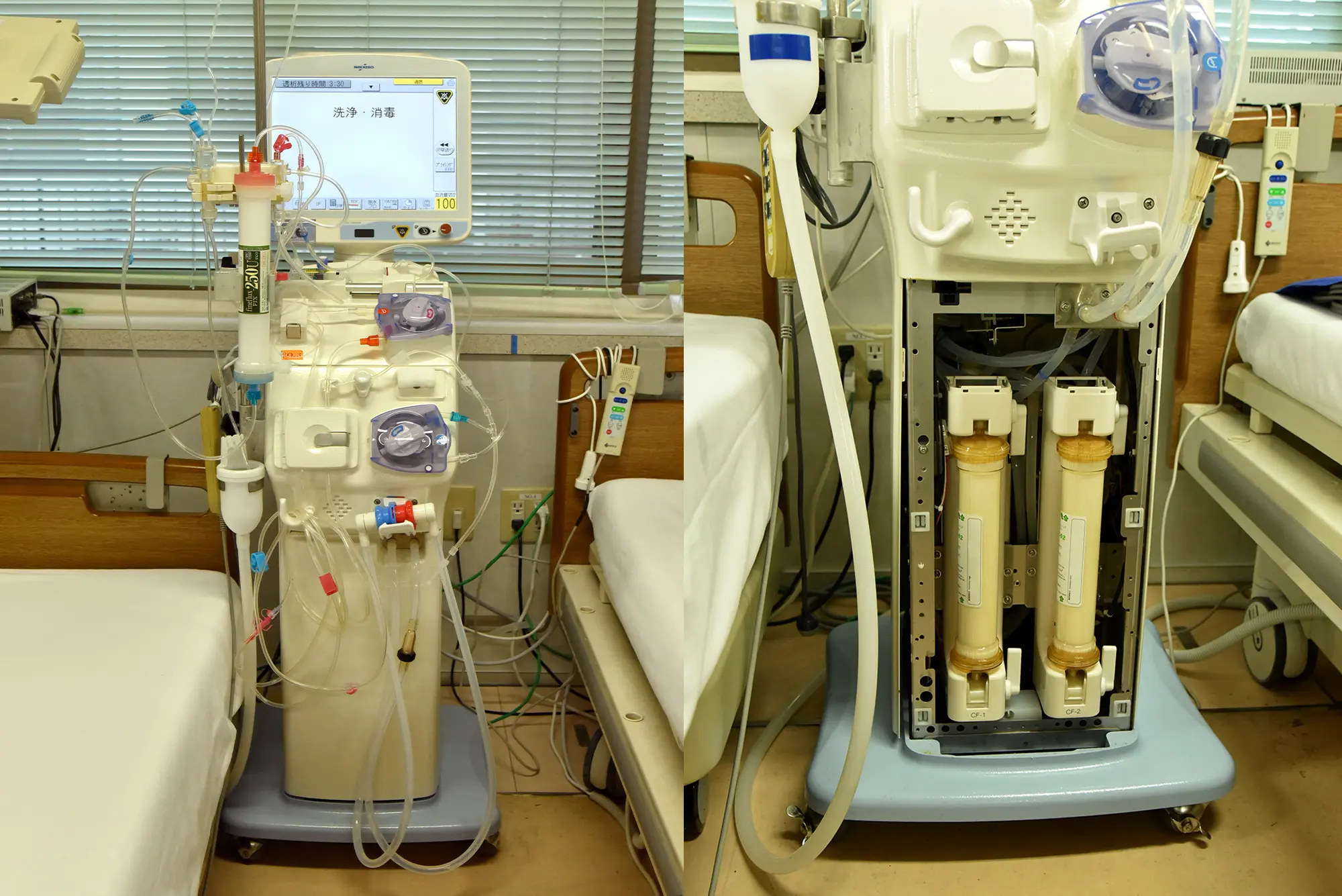 透析液清浄化のための装置の写真